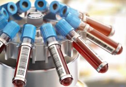 Blood test tubes in centrifuge. Medical laboratory concept. 3d illustration